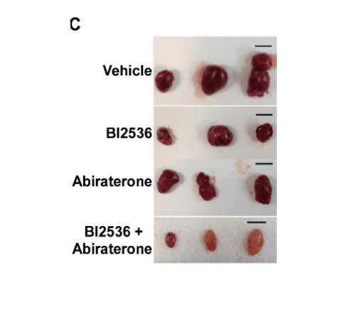 Excised prostate tumors from vehicle, BI2536, abiraterone, and the combination groups.